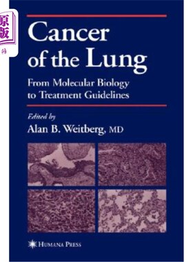海外直订医药图书Cancer of the Lung: From Molecular Biology to Treatment Guidelines 肺癌：从分子生物学到治疗指南