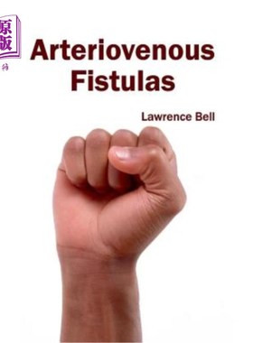 海外直订医药图书Arteriovenous Fistulas 动静脉瘘