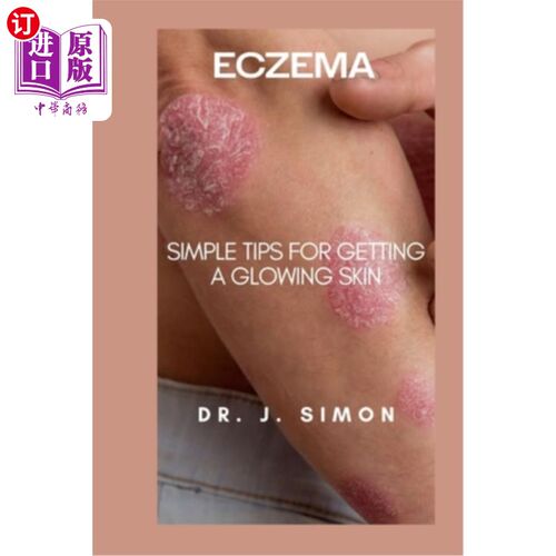 海外直订医药图书Eczema: Simple Tips for Getting a Glowing Skin 湿疹：让皮肤容光焕发的简单小贴士