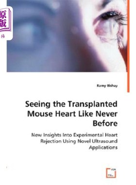 海外直订医药图书Seeing the Transplanted Mouse Heart Like Never Before 前所未有地看到移植的老鼠心脏