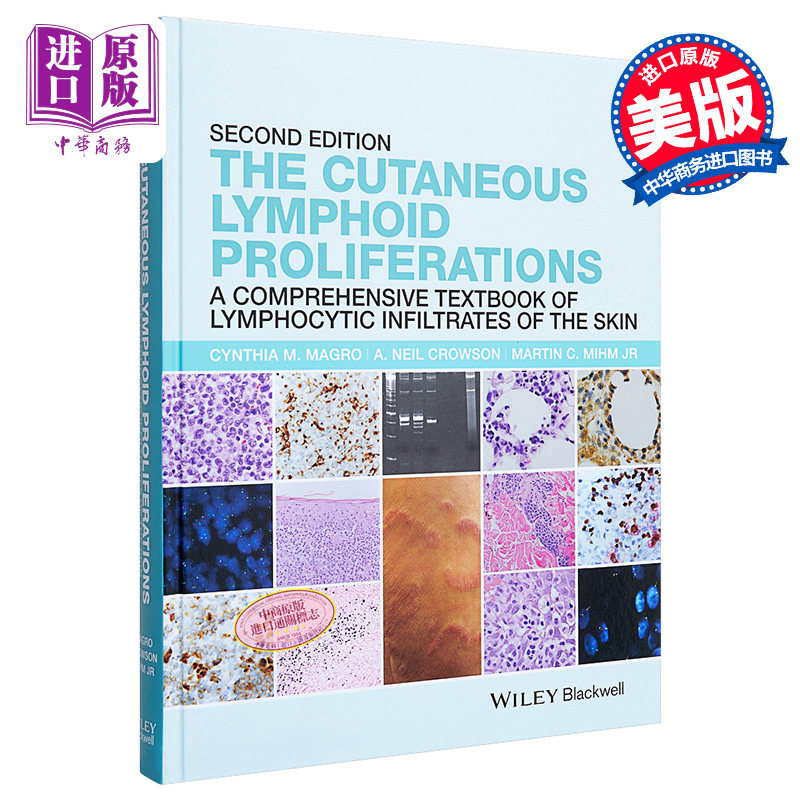 皮肤淋巴增殖 皮肤淋巴细胞浸润综合教材 the cutaneous lymphoid