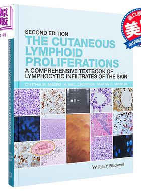 皮肤淋巴增殖 皮肤淋巴细胞浸润综合教材 The Cutaneous Lymphoid Proliferations 英文原版 Cynthia Magro【中商原版】Wiley