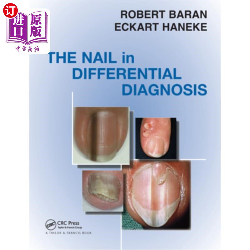 海外直订医药图书The Nail in Differential Diagnosis 鉴别诊断中的钉子