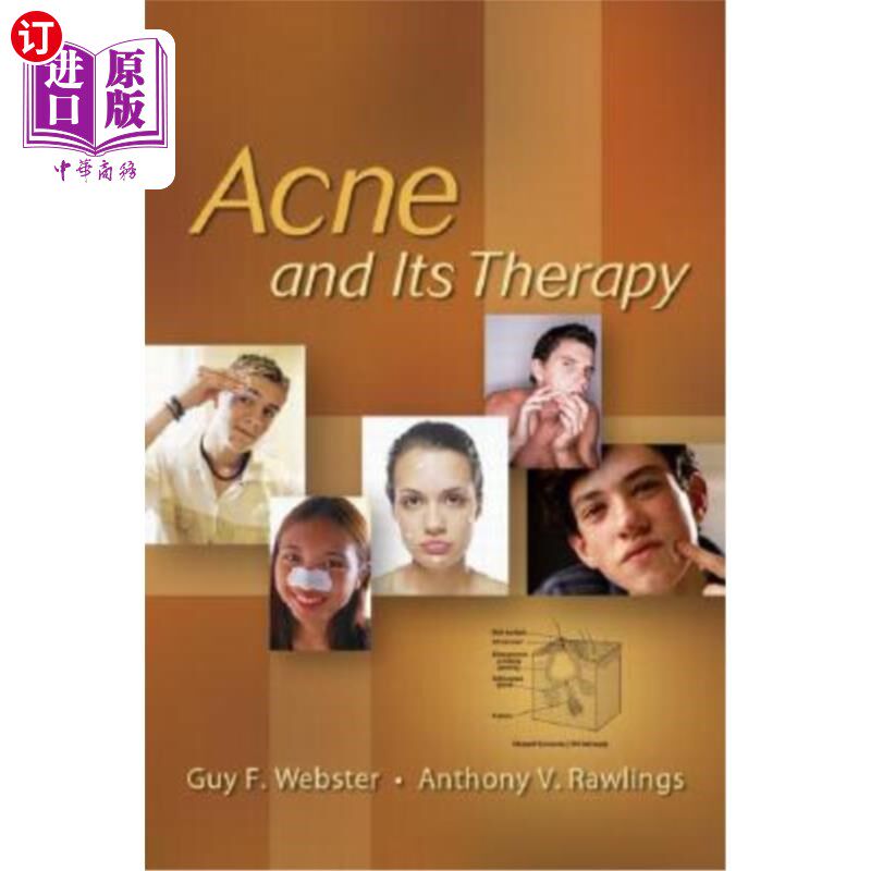 海外直订医药图书Acne and Its Therapy 痤疮及其治疗
