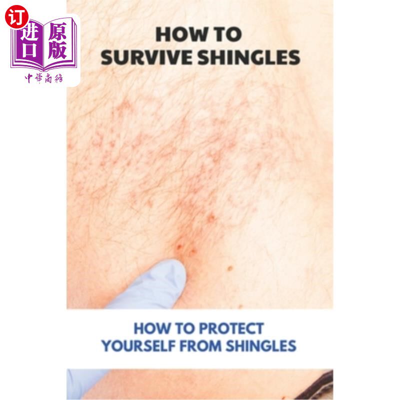 海外直订医药图书How To Survive Shingles: How To Protect Yourself From Shingles: How To Speed Up 如何度过带状疱疹: