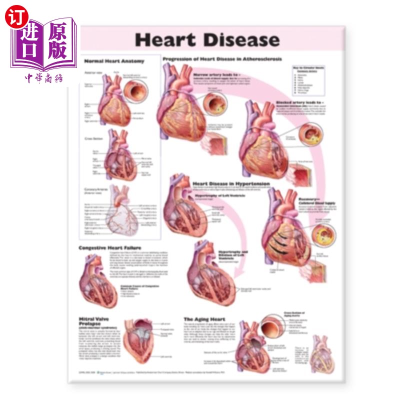 海外直订医药图书Heart Disease Anatomical Chart 心脏病解剖图