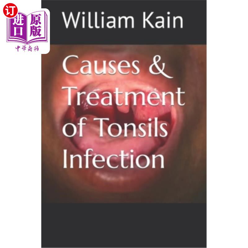 海外直订医药图书Causes & Treatment of Tonsils Infection 扁桃体感染的原因及治疗