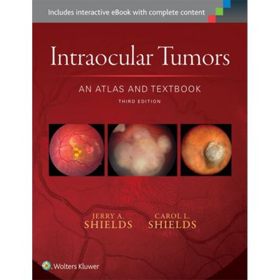 现货 眼内肿瘤 图解及教材 第3版 英文原版 Intraocular Tumors Jerry A Shields【中商原版】