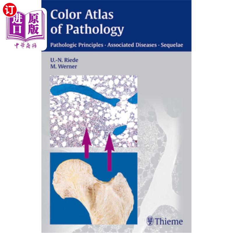 海外直订医药图书Color Atlas of Pathology: Pathologic Principles, Associated Diseases, Sequela 病理学彩色图集:病理原