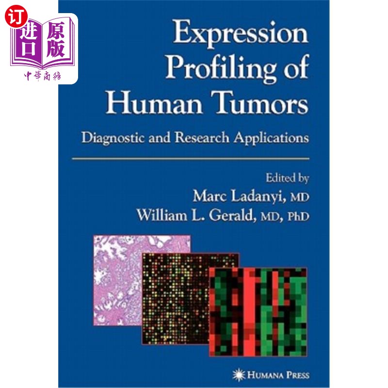海外直订医药图书Expression Profiling of Human Tumors: Diagnostic and Research Applications 人类肿瘤的表达谱:诊断和