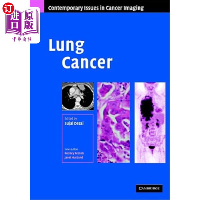 海外直订医药图书Lung Cancer 肺癌
