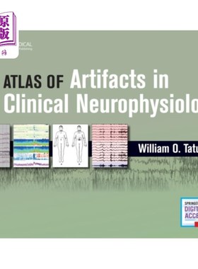 海外直订医药图书Artifacts in Clinical Neurophysiology 临床神经生理学的伪影