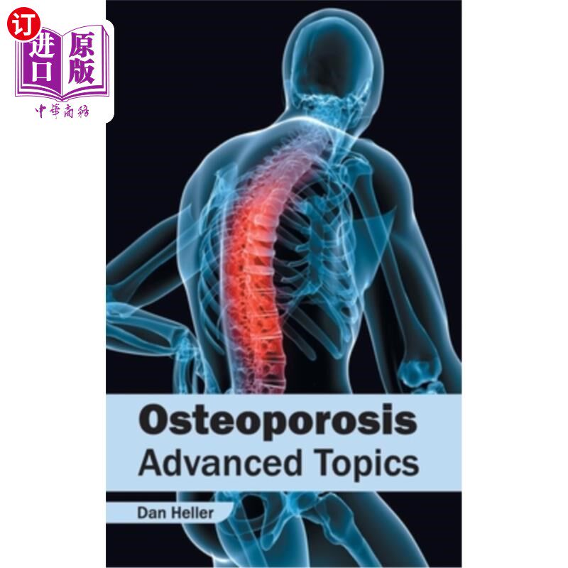 海外直订医药图书Osteoporosis: Advanced Topics 骨质疏松症：高级话题