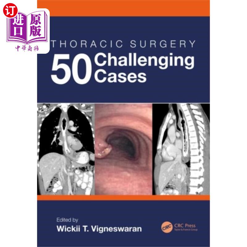 海外直订医药图书Thoracic Surgery: 50 Challenging cases 胸部外科50例