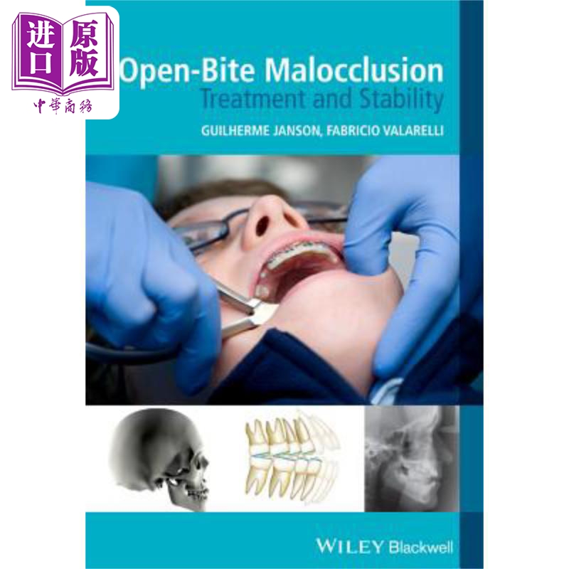 现货 开位错牙合 处理和稳定性 Open-Bite Malocclusion: Treatment and Stability 英文原版 Guilherme Janson 中商�