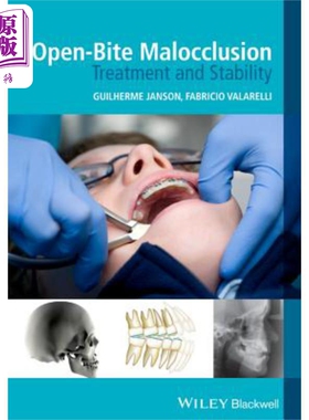 现货 开位错牙合 处理和稳定性 Open-Bite Malocclusion: Treatment and Stability 英文原版 Guilherme Janson 中商�