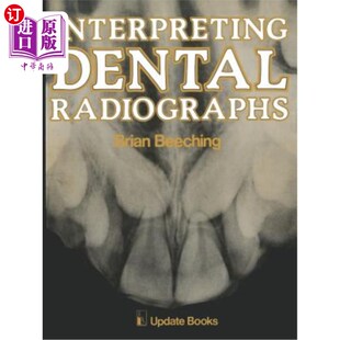 海外直订医药图书Interpreting Dental Radiographs 解读牙科放射照片