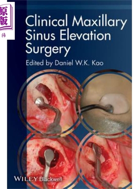 现货 临床上颌窦提升术 Clinical Maxillary Sinus Elevation Surger【中商原版】