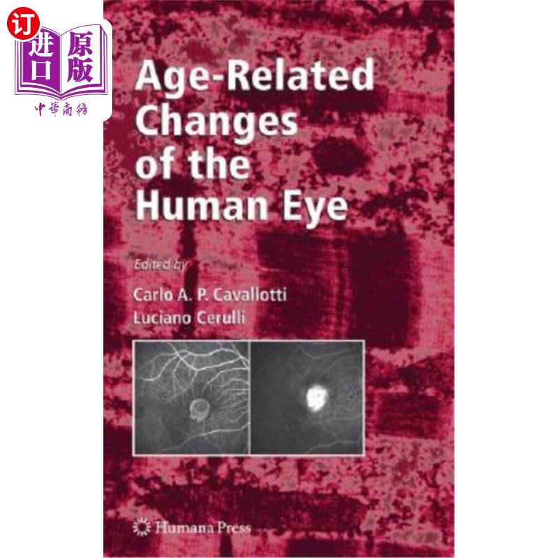 海外直订医药图书Age-Related Changes of the Human Eye 与年龄有关的人眼变化