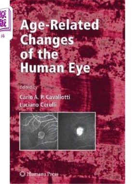 海外直订医药图书Age-Related Changes of the Human Eye 与年龄有关的人眼变化