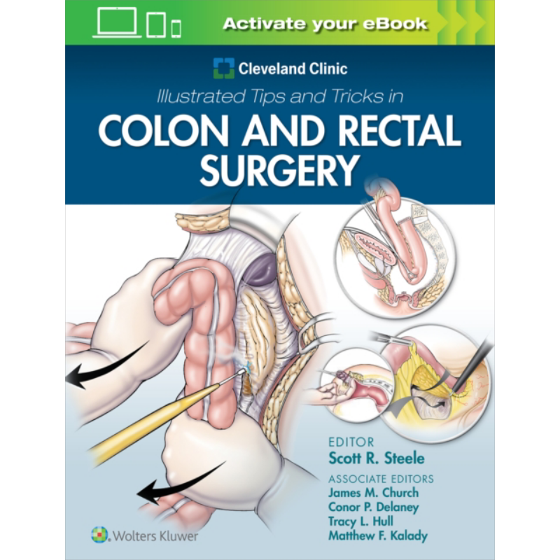 克里夫兰医疗中心结直肠外科技术与技巧手册 英文原版 Cleveland Clinic Illustrated in Colon and Rectal Surgery【中商原?