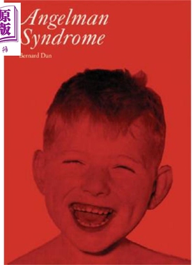 现货 Angelman氏症候群 Angelman S Syndrome Bernard Dan 英文原版【中商原版】