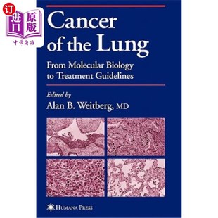 海外直订医药图书Cancer of the Lung: From Molecular Biology to Treatment Guidelines 肺癌：从分子生物学到治疗指南