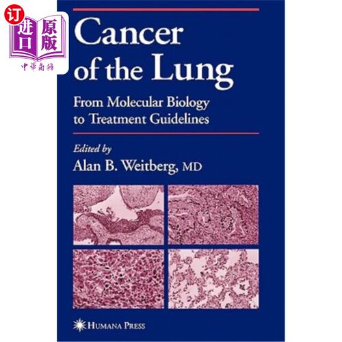 海外直订医药图书Cancer of the Lung: From Molecular Biology to Treatment Guidelines 肺癌：从分子生物学到治疗指南