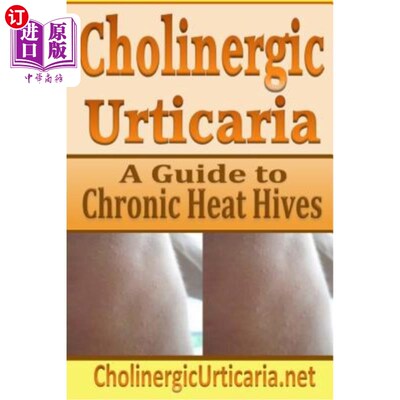 海外直订医药图书Cholinergic Urticaria: A Guide to Chronic Heat Hives 胆碱能性荨麻疹：慢性热荨麻疹指南