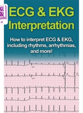 海外直订医药图书ECG & EKG Interpretation: How to interpret ECG & EKG, including rhythms, arrhyth 心电图和心电图解释