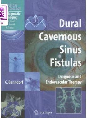 海外直订医药图书Dural Cavernous Sinus Fistulas: Diagnosis and Endovascular Therapy 硬脑膜海绵窦瘘的诊断与血管内治疗