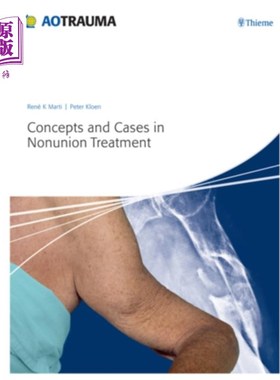 海外直订医药图书Concepts and Cases in Nonunion Treatment 骨不连处理的概念与案例