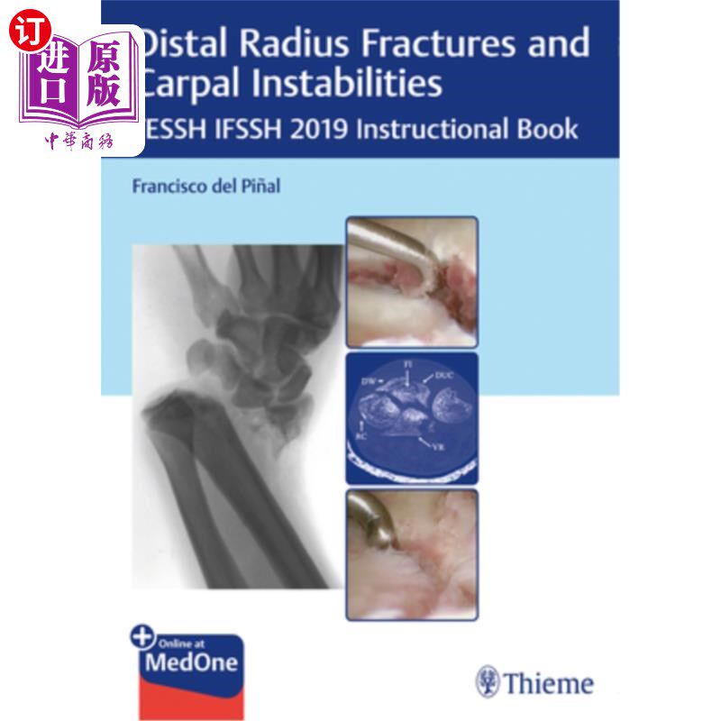 海外直订医药图书Distal Radius Fractures and Carpal Instabilities: Fessh Ifssh 2019 Instructional 桡骨远端骨折和腕关