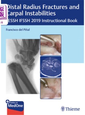海外直订医药图书Distal Radius Fractures and Carpal Instabilities: Fessh Ifssh 2019 Instructional 桡骨远端骨折和腕关