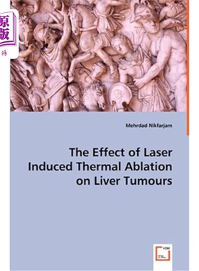 海外直订医药图书The Effect of Laser Induced Thermal Ablation on Liver Tumours 激光诱导热消融治疗肝癌的疗效