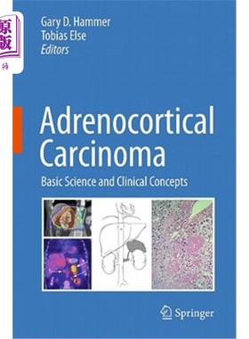 海外直订医药图书Adrenocortical Carcinoma: Basic Science and Clinical Concepts 肾上腺皮质癌：基础科学和临床概念