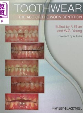 现货 牙列磨损基本知识 Toothwear The ABC of the Worn Dentition 英文原版 Farid Khan【中商原版】Wiley