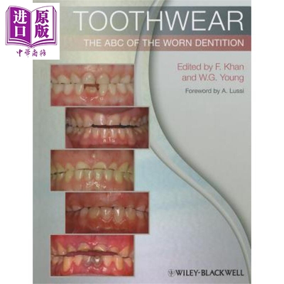 现货 牙列磨损基本知识 Toothwear The ABC of the Worn Dentition 英文原版 Farid Khan【中商原版】Wiley
