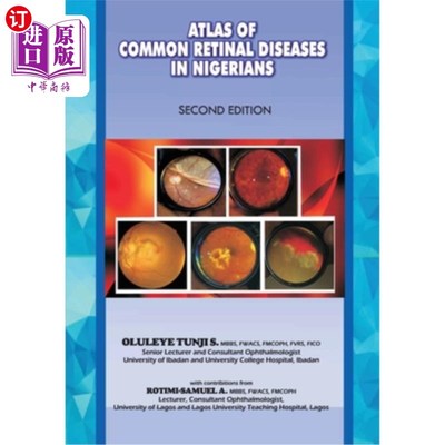 海外直订医药图书The Atlas of Retinal Diseases in Nigerians 尼日利亚人视网膜疾病图谱