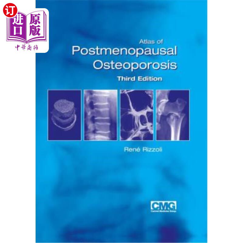 海外直订医药图书Atlas of Postmenopausal Osteoporosis: Third Edition 绝经后骨质疏松症图集:第三版