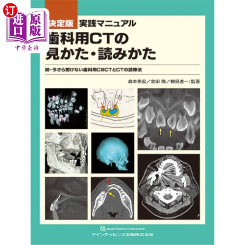 海外直订日语 実践マニュアル歯科用ＣＴの見かた・読みかた　決定版　今さら聞けない歯科用ＣＢＣＴとＣＴの読像法　続 实