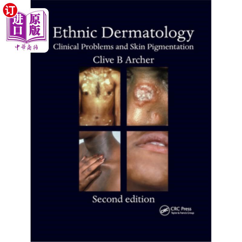 海外直订医药图书Ethnic Dermatology: Clinical Problems and Skin Pigmentation 民族皮肤病学:临床问题和皮肤色素沉着