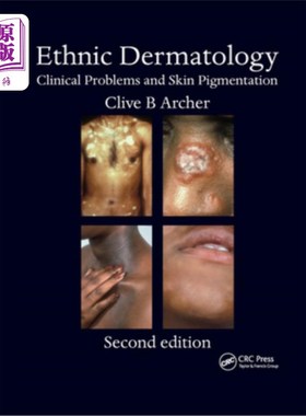 海外直订医药图书Ethnic Dermatology: Clinical Problems and Skin Pigmentation 民族皮肤病学:临床问题和皮肤色素沉着