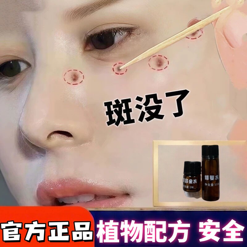 美容金水修复液套装点斑水祛雀斑晒斑老年斑美容院专用同款不留疤