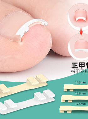 镍钛合金嵌甲钩物理拉伸甲沟卷甲正甲贴小巧隐形穿鞋可行走