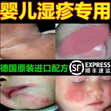 湿疹婴儿专用婴幼儿去口水疹热疹奶藓膏痤疮儿童特应性皮炎止痒根