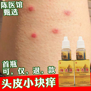 头皮发痒发红止痒头皮痒专用止头痒用什么中药非洗头膏洗发水液露