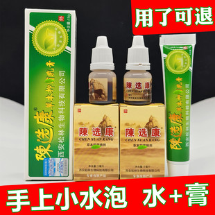 手上起小水泡手掌手指手痒起小水泡痒汗疱汗泡抑菌乳膏抑菌液喷雾