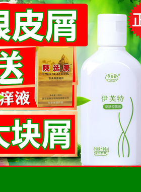 头上大块头皮屑去头屑专用洗发水