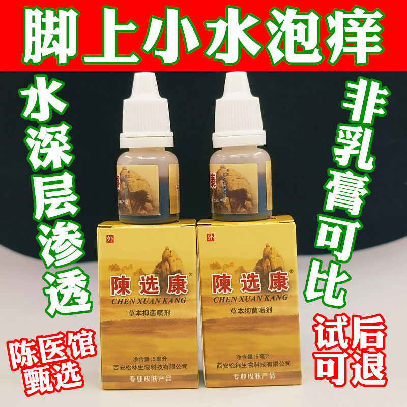 脚上长小水泡脚底上脚底起小水泡脚上起小水泡又痒又脱皮抑菌液水